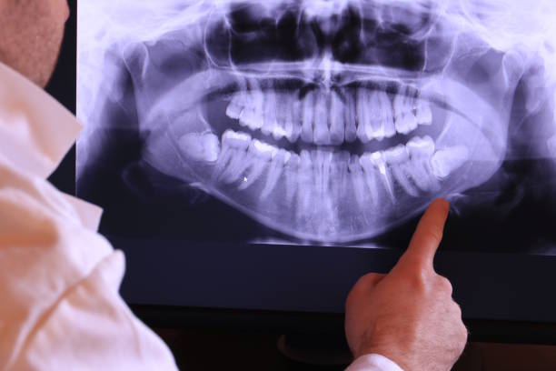 Best Knocked-Out Tooth Emergency  in Mayville, WI